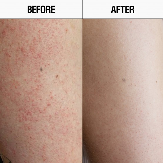 Grown Alchemist Resurfacing Targeted Body Cleanser & Lotion - Набір для глибокого оновлення та сяяння шкіри тіла