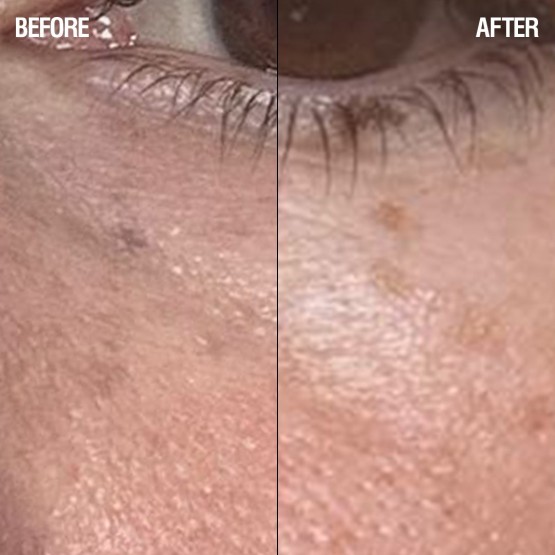 Grown Alchemist Regenerating Eye Cream - Регенеруючий крем для шкіри навколо очей, 15 мл