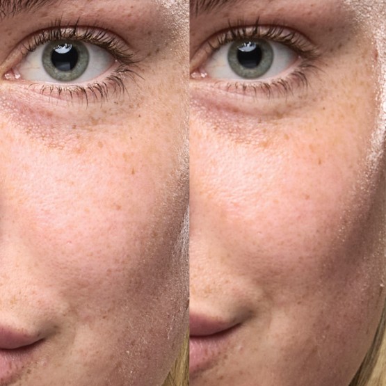 Grown Alchemist Skin Renewal Serum - Відновлююча сироватка для обличчя Ніацинамід, Ашваганда, Ехінацея, 25 мл
