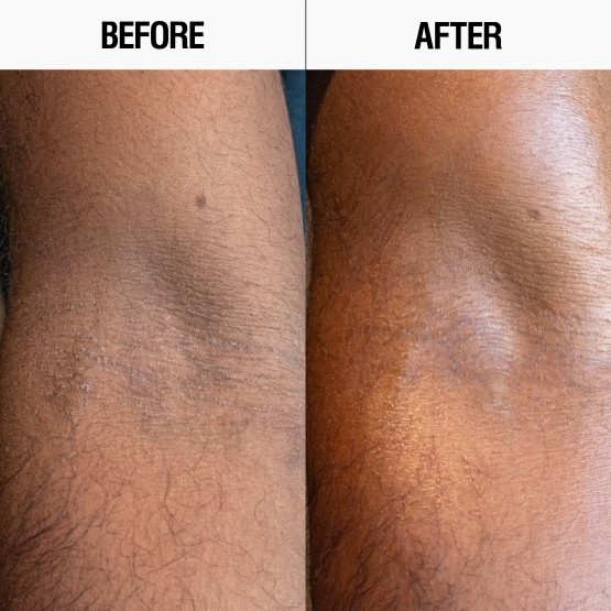 Grown Alchemist Resurfacing Targeted Body Lotion - Лосьйон для регенерації та вирівнювання мікрорельєфу тіла, 300 мл